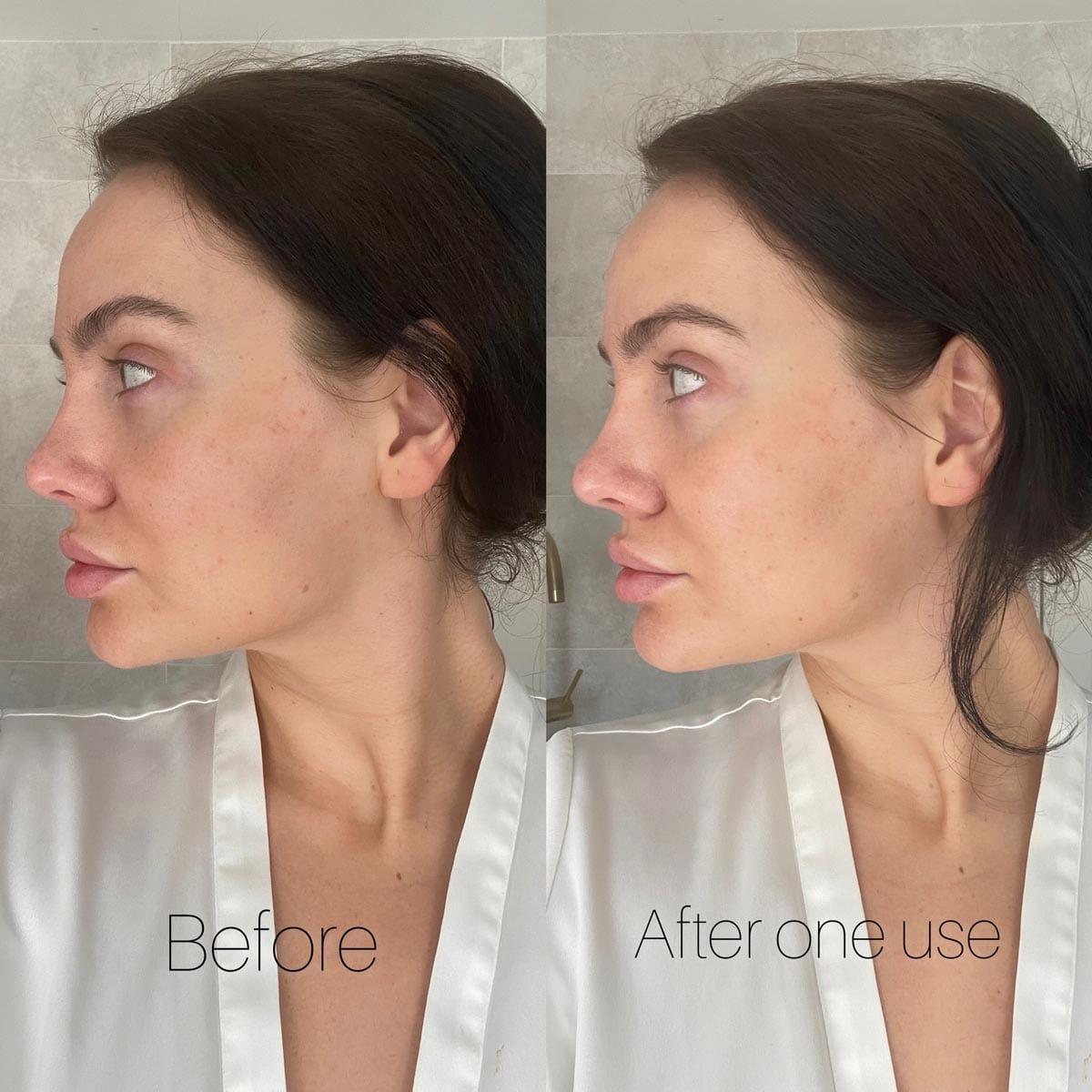 Before and after comparison of a woman's face with text indicating 'Before' and 'After one use'.