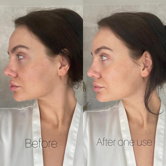 Before and after comparison of a woman's face with text indicating 'Before' and 'After one use'.